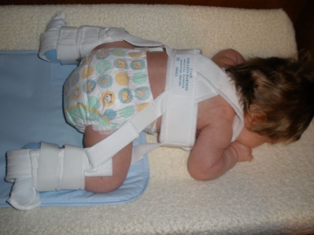 Pavlik Harness on Baby