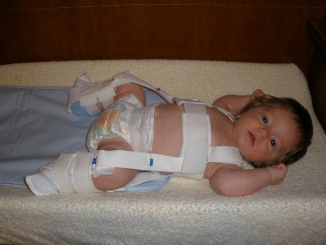 Pavlik Harness on Baby
